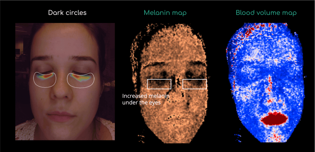Biomarker maps within the skin analysis
